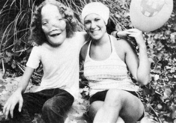 Rocky Dennis