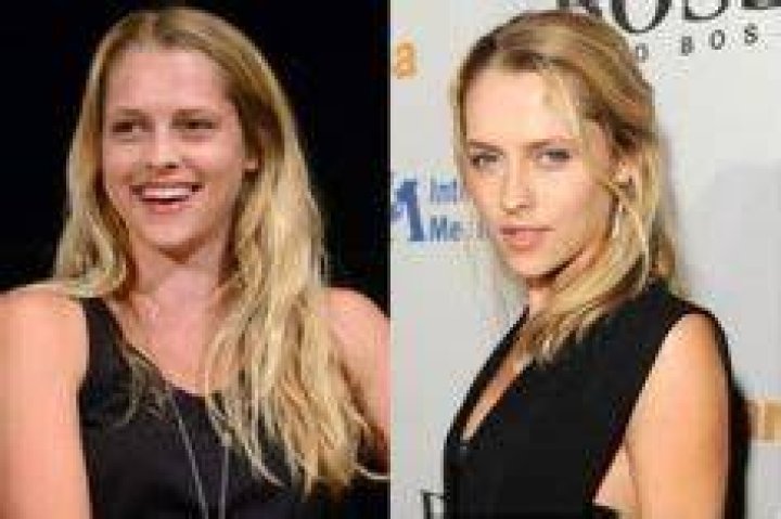 Teresa Palmer Plastic Surgery Before and After